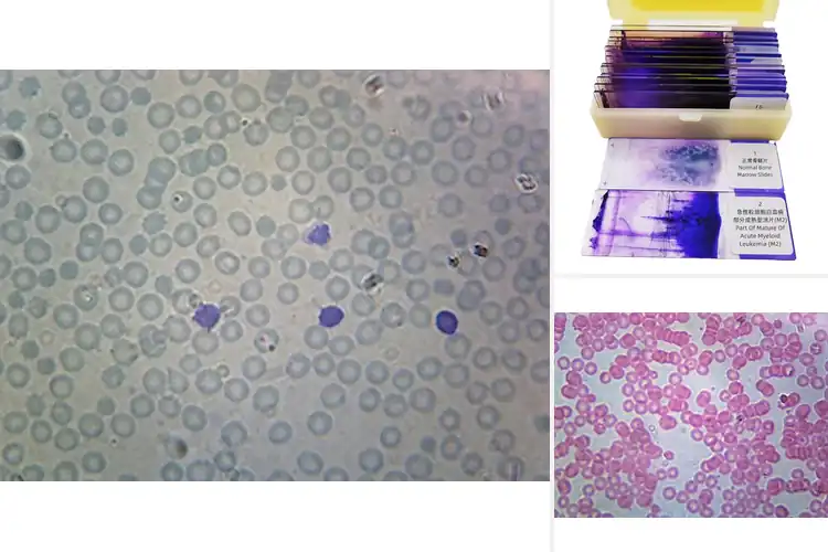 Detailed view of Best Blood Smear Slides